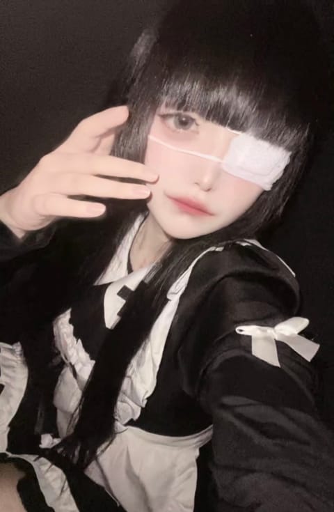 さそりのブログ写真「眼帯してんじゃん」